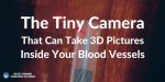 The-Tiny-Camera-That-Can-Take-3d-Pictures-Inside-Your-Blood-Vessels.jpg