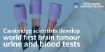 Cambridge-scientists-develop-world-first-brain-tumour-urine-and-blood-tests.jpeg:cts:1:214